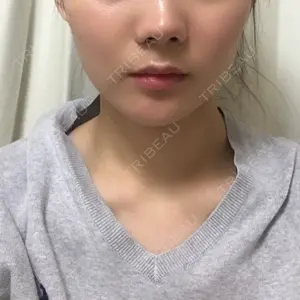 11 days after image