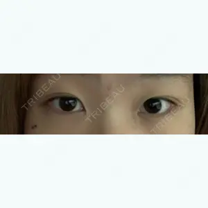 49 days after image