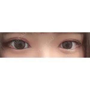30 days after image
