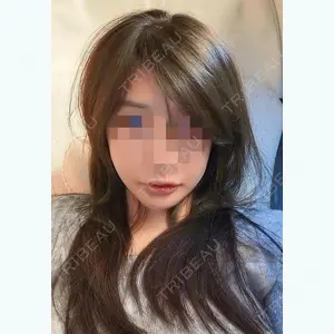 344 days after image