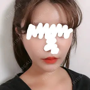 30 days after image