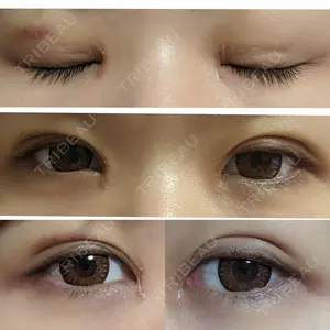 22 days after image