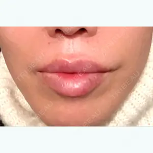8 days after image
