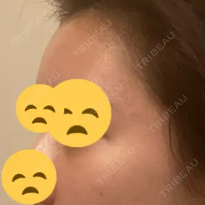 22 days after image