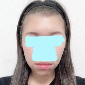 30 days after image