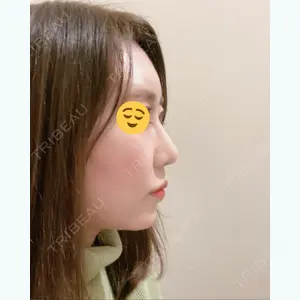 80 days after image