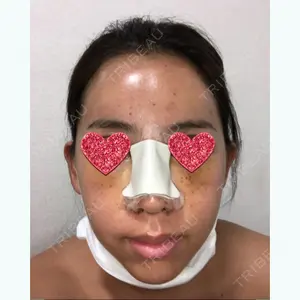 シンミアン形成外科口コミ