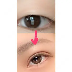 1 days after image