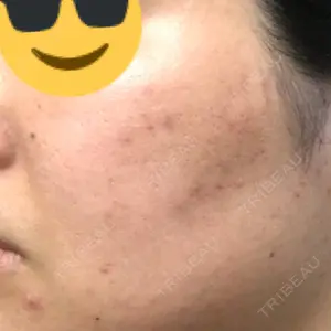 6 days after image