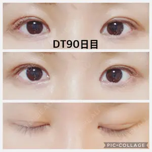 90 days after image