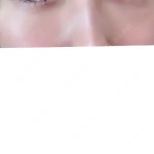 14 days after image
