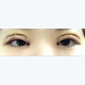 3 days after image