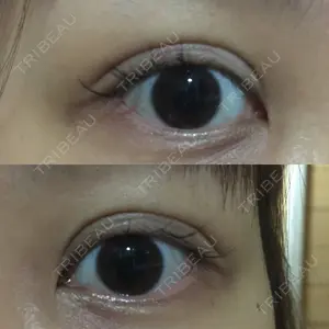 9 days after image