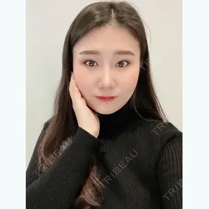 61 days after image