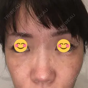 7 days after image