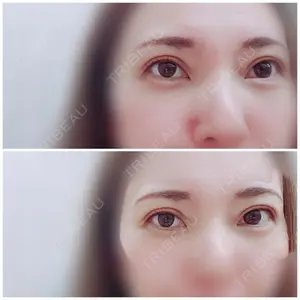 89 days after image