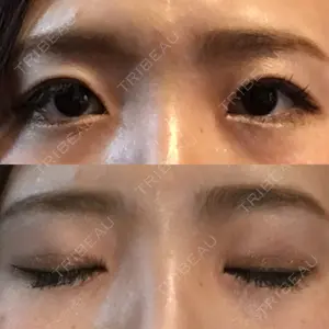 100 days after image