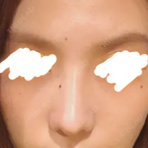 42 days after image
