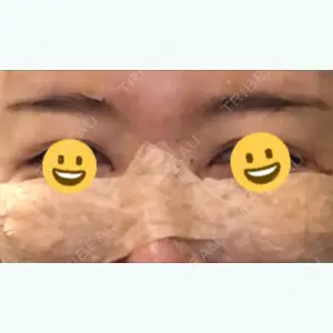 0 days after image