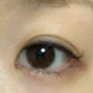 73 days after image