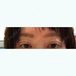 13 days after image
