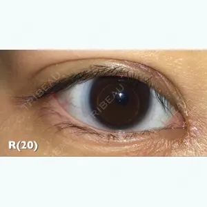 19 days after image