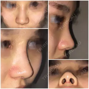 15 days after image