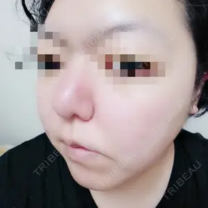 16 days after image