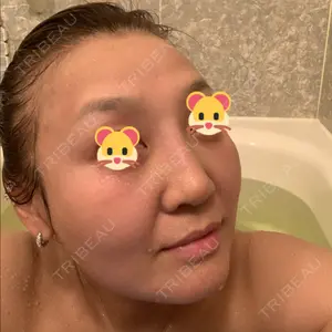 7 days after image