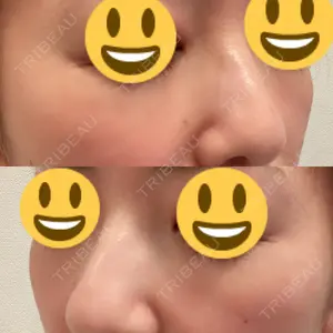 61 days after image