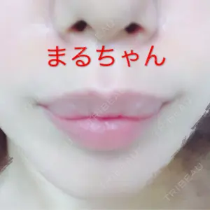 34 days after image