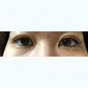 9 days after image