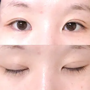 25 days after image