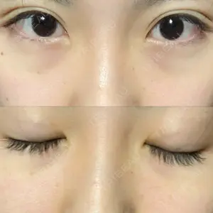 30 days after image