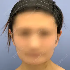 608 days after image