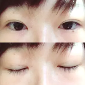 36 days after image