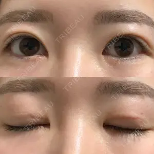 104 days after image
