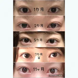 335 days after image