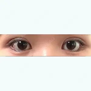31 days after image