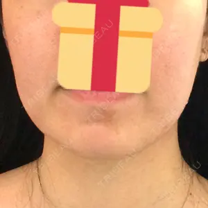 170 days after image
