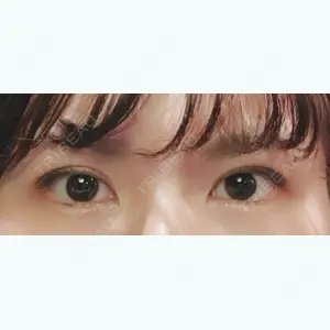 77 days after image