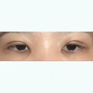 9 days after image