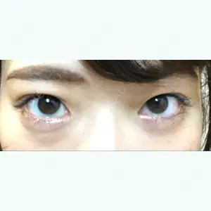 159 days after image