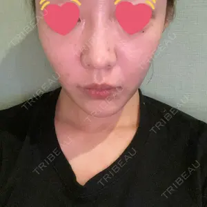 58 days after image