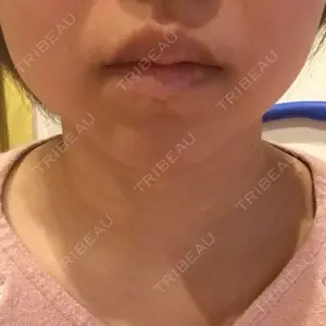 36 days after image