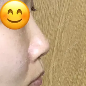 92 days after image