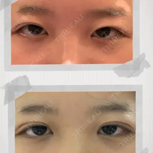 12 days after image