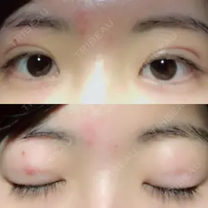 52 days after image