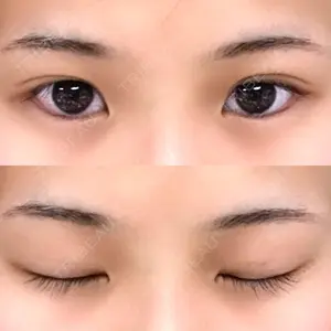 27 days after image