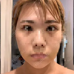6 days after image
